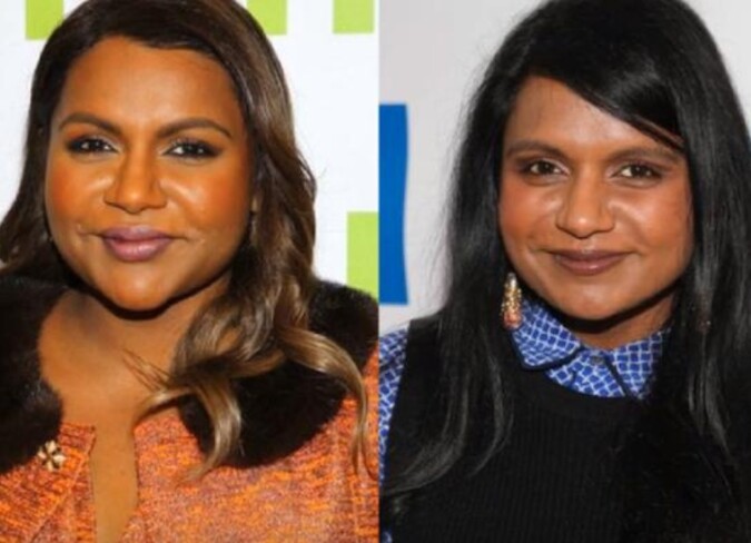 Mindy Kaling Plastic Surgery