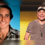 Paul Simon Plastic Surgery