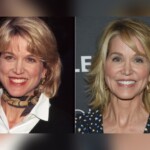 Paula Zahn Plastic Surgery