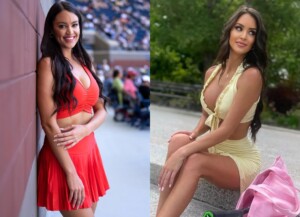 Rachel Stuhlmann Plastic Surgery: This Is What Fan Thinks About Her