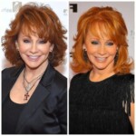 Reba McEntire Plastic Surgery