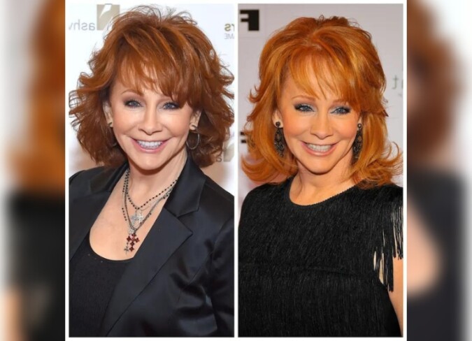 Reba McEntire Plastic Surgery: Did She Undergo Surgery?