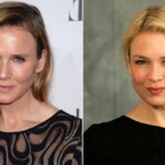 Renee Zellweger Plastic Surgery