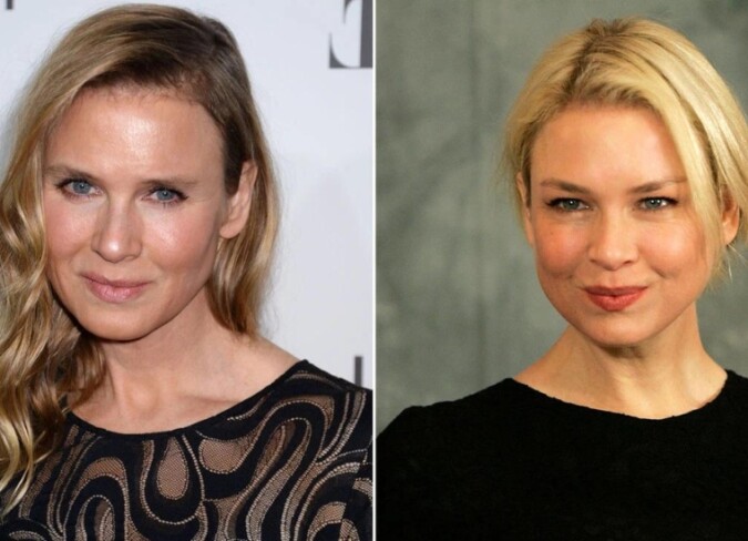 Renee Zellweger Plastic Surgery