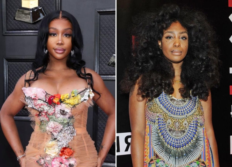 SZA Seems to Confirm Plastic Surgery Rumors