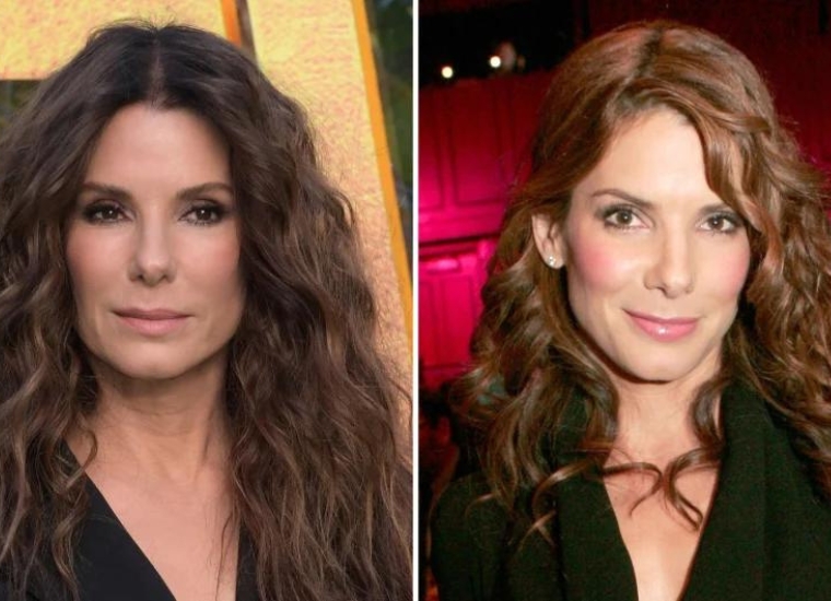 Sandra Bullock Plastic Surgery 2024