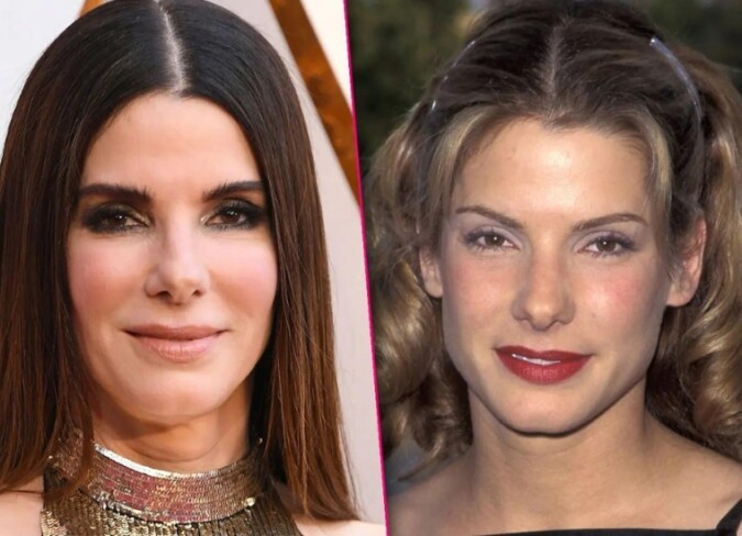 Sandra Bullock Plastic Surgery