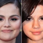 Selena Gomez Plastic Surgery