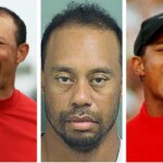 Tiger Woods Plastic Surgery