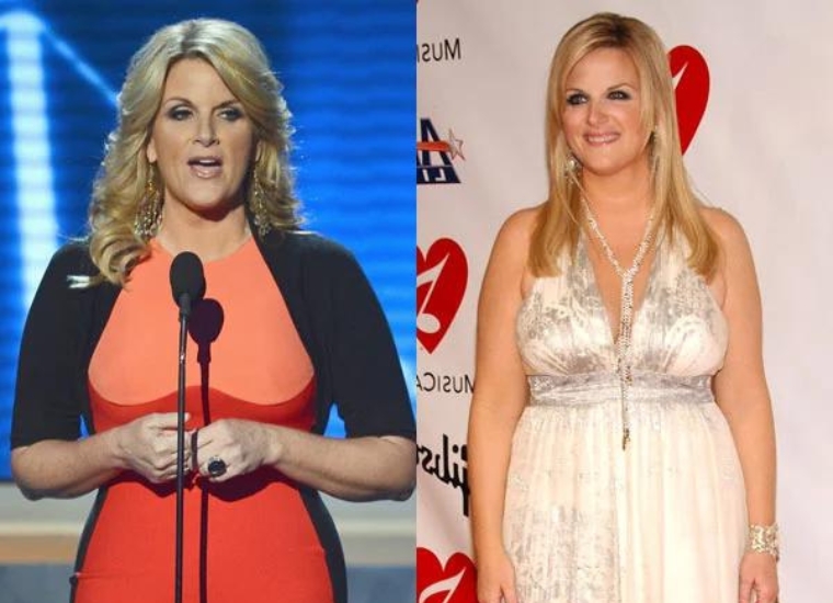 Trisha Yearwood Weight Loss 2024