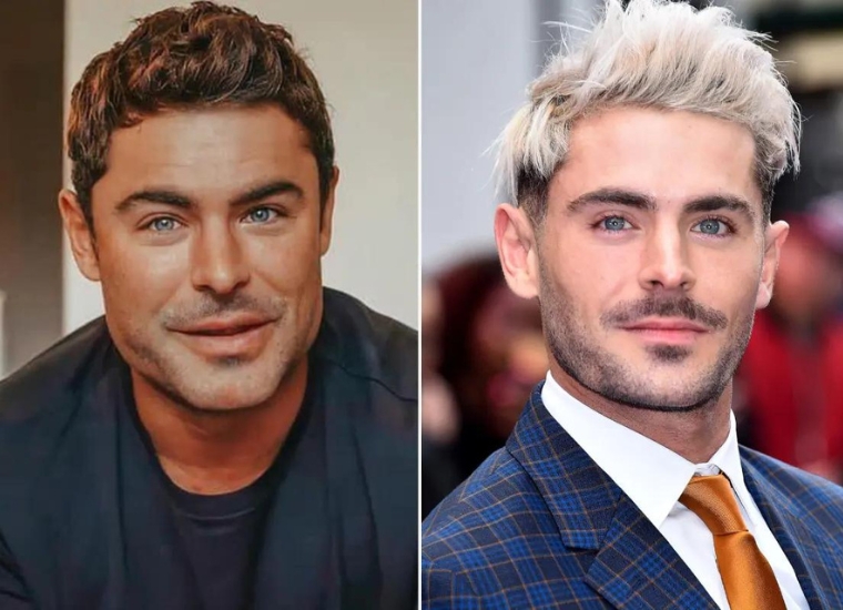 Zac Efron Plastic Surgery Accident